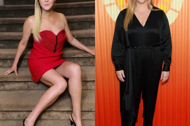 AMY SCHUMER SAID ONE MEDICAL PROCEDURE LEFT HER “NOT FEELING VERY SEXUAL,” AND SUDDENLY THE INTERNET WAS STARING AT HER BODY ALL OVER AGAIN.